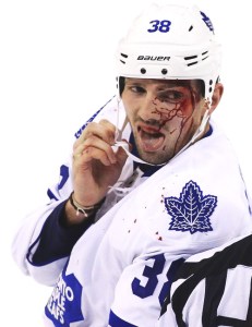 Fraser McLaren after a nasty scrap. 